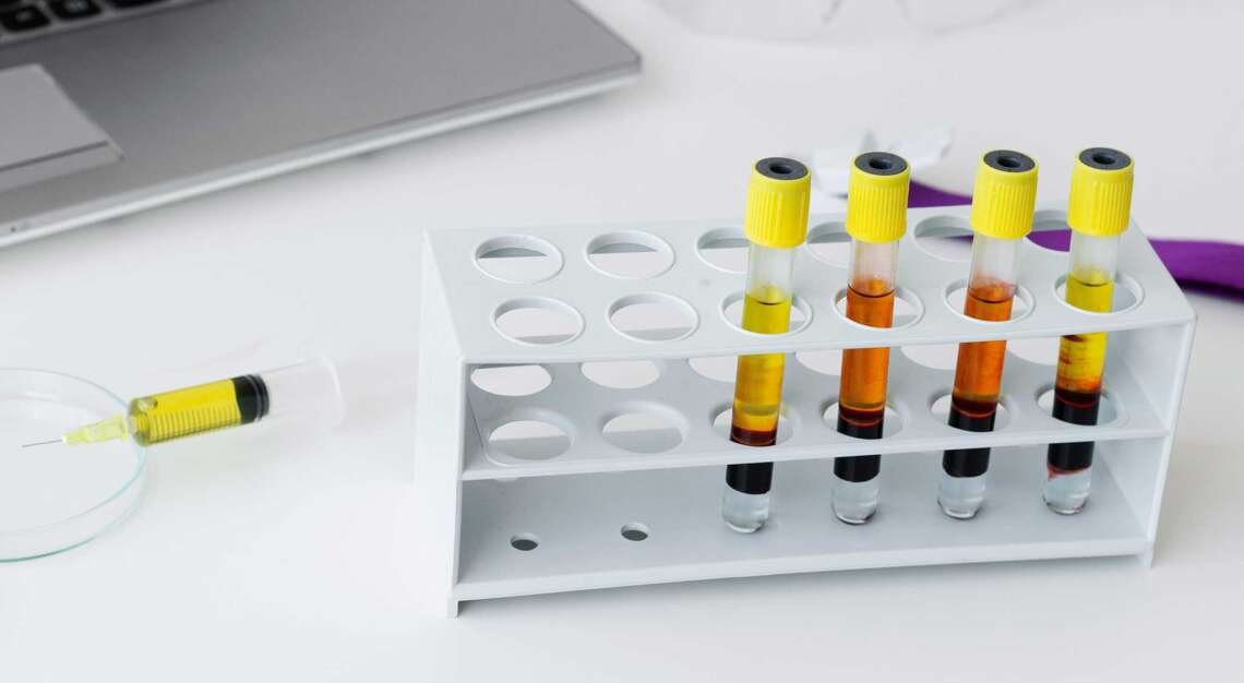 PRP (Platelet Rich Plasma)